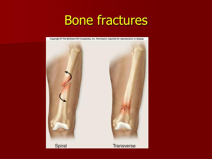 PPT - CHAPTER 6-2 PowerPoint Presentation - ID:727339