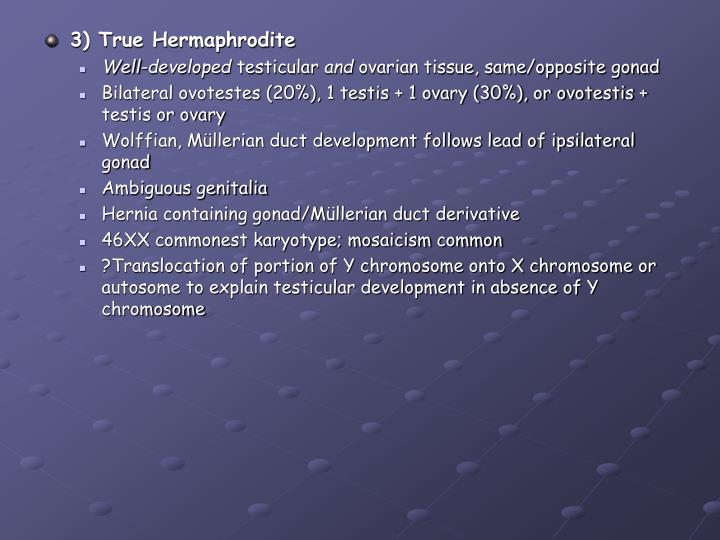 PPT Ambiguous Genitalia Neonatal Presentation PowerPoint Presentation ID730795