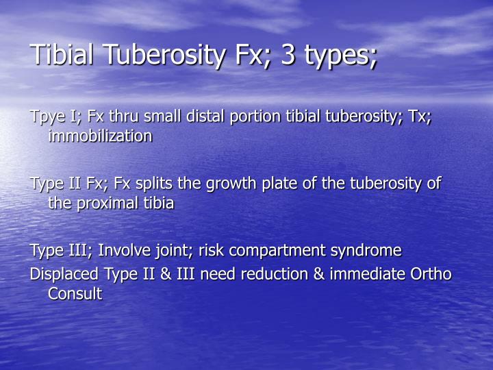 PPT - Musculoskeletal Disorders in Children PowerPoint Presentation ...