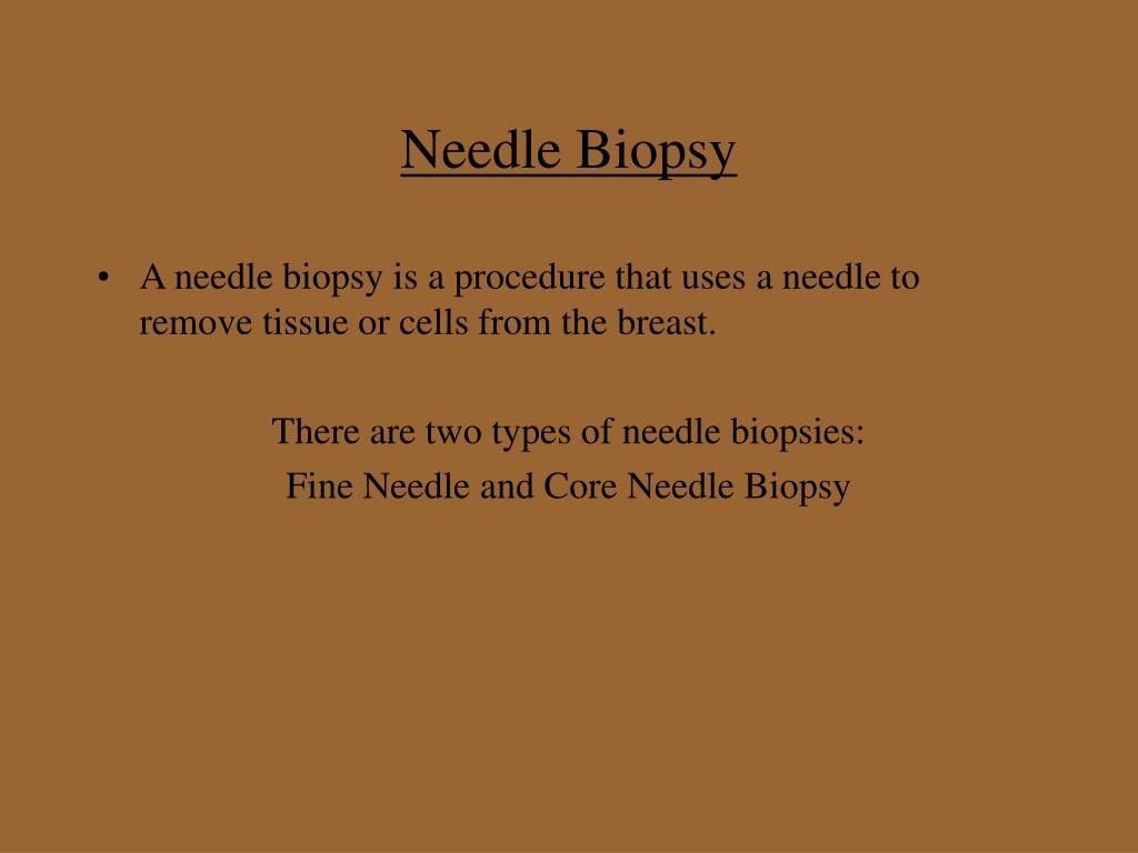 PPT - Breast Biopsy PowerPoint Presentation, free download
