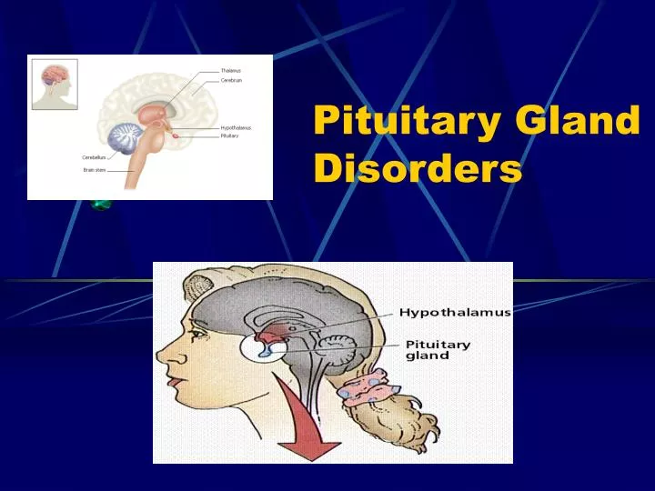 pituitary gland disorders n.