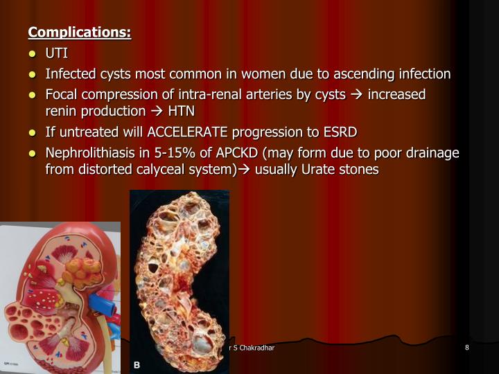 PPT CYSTIC DISEASE OF KIDNEY PowerPoint Presentation ID734036