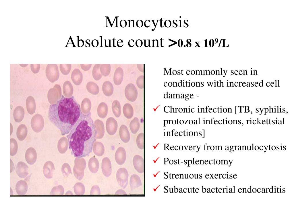 Моноцитов в крови 1. Моноцитоз. Моноцитоз и нейтропения. Моноцитоз симптомы.