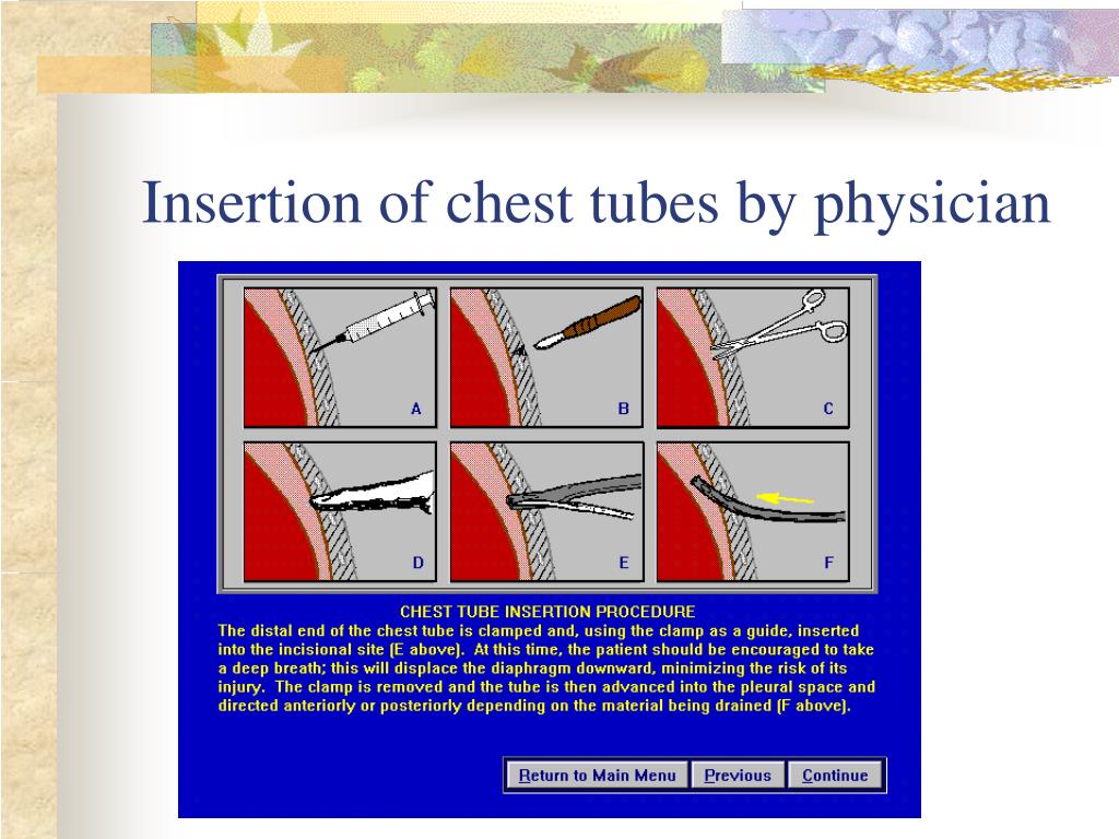 chest tube insertion new england journal of medicine chest tube insertion new england journal of medicine