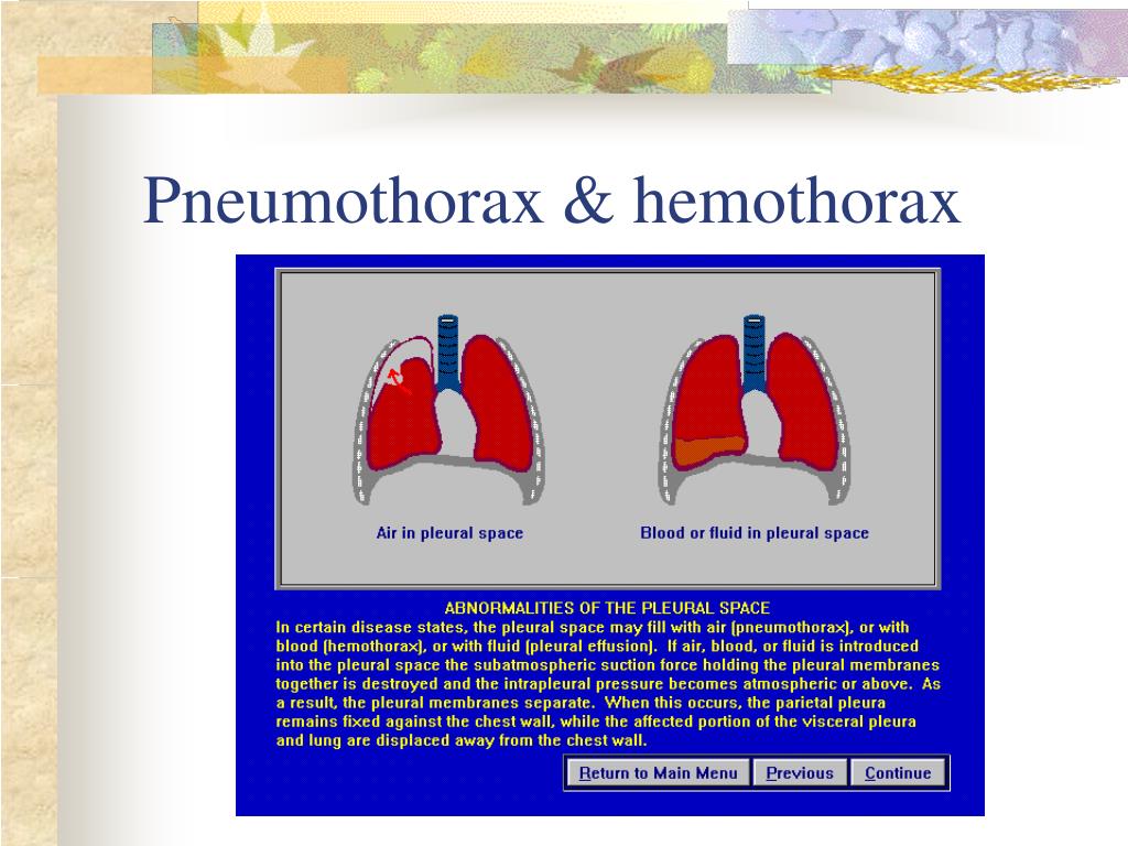 PPT Respiratory PowerPoint Presentation, free download ID735590