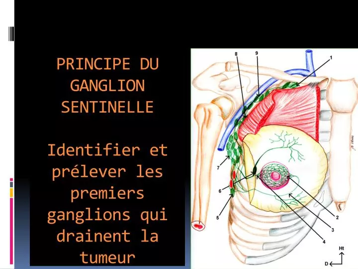 PPT PRINCIPE DU GANGLION SENTINELLE Identifier et prélever les premiers ganglions qui drainent