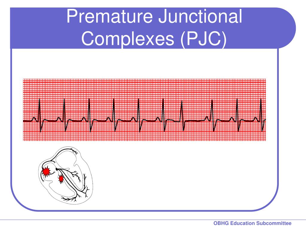 Ppt Chapter 2 For 12 Lead Training Rhythm Practice Powerpoint Presentation Id 7424