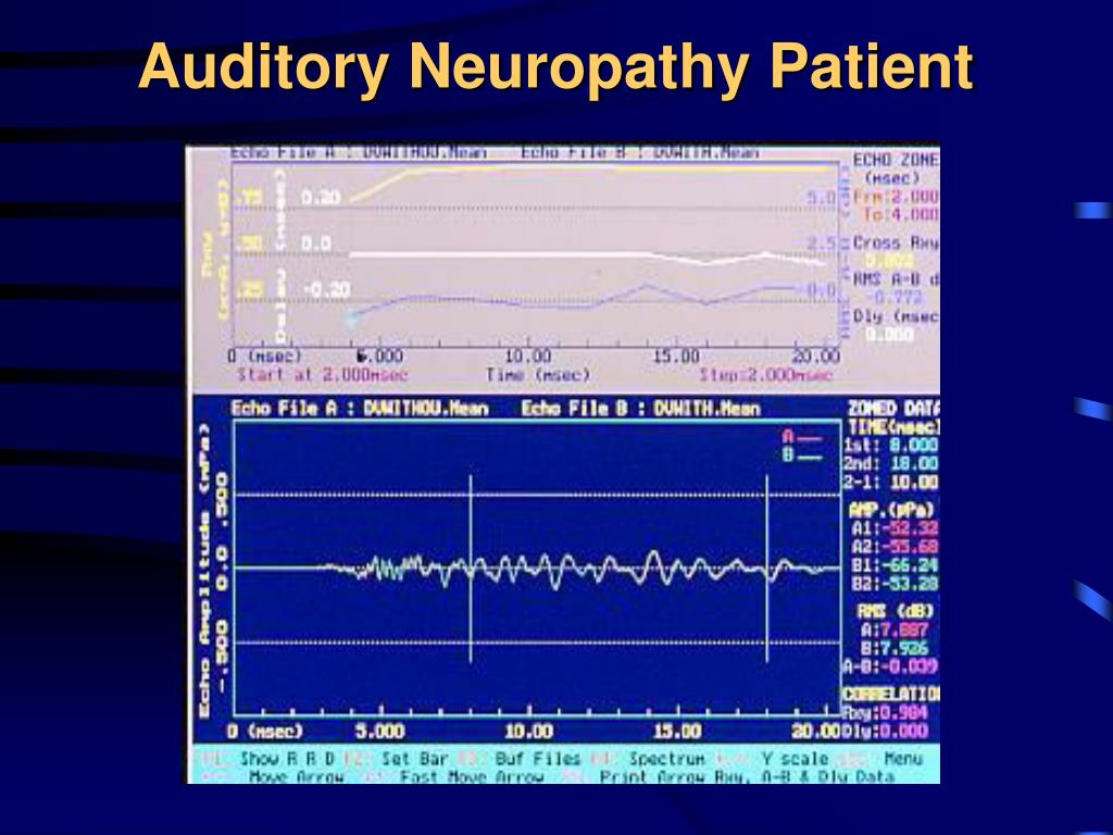 auditory neuropathy auditory neuropathy