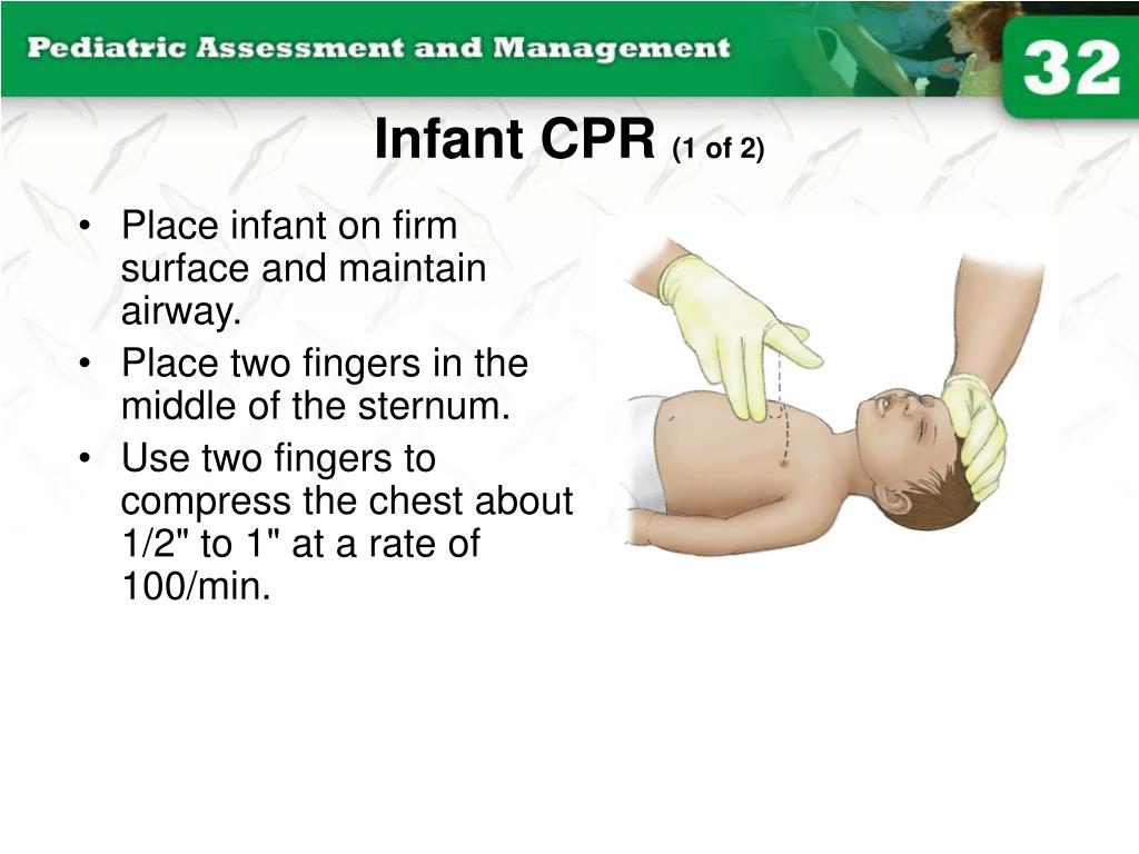 PPT Infant CPR 1 of 2 PowerPoint Presentation free download