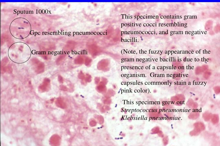 PPT - Gram Stain Review PowerPoint Presentation - ID:751857