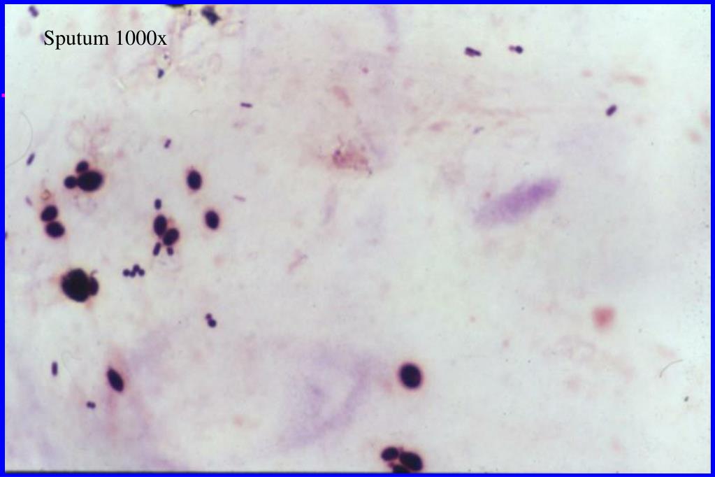 stain precipitate stain precipitate