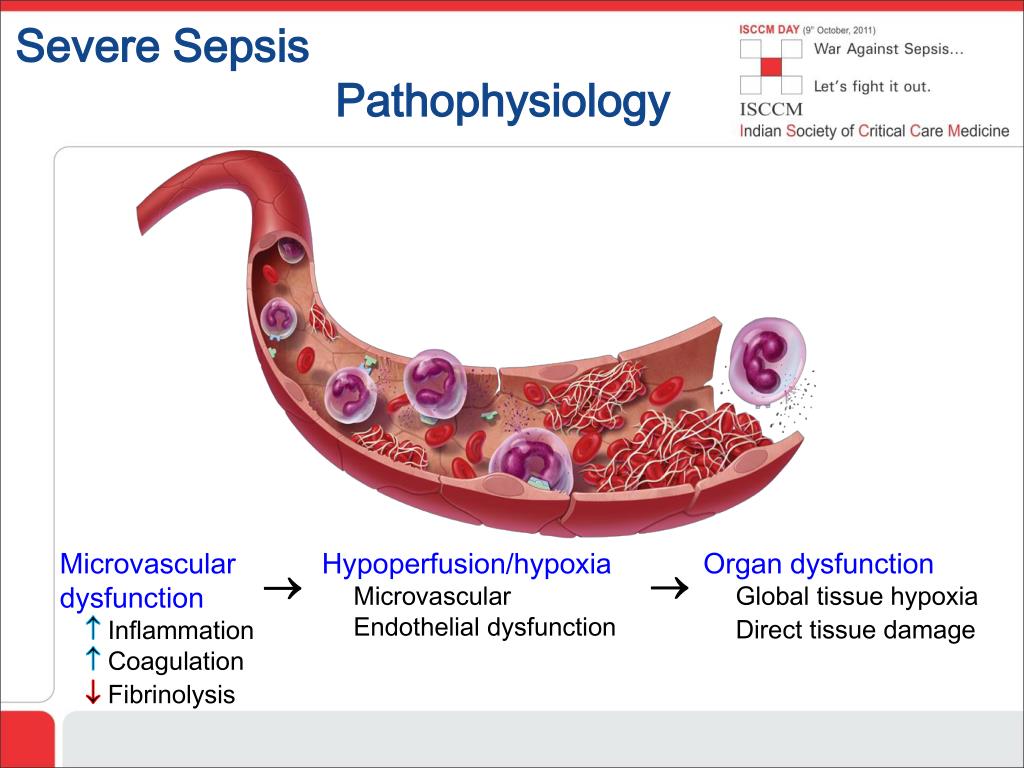 PPT - War Against Sepsis Case Based Sepsis Module (Based ...