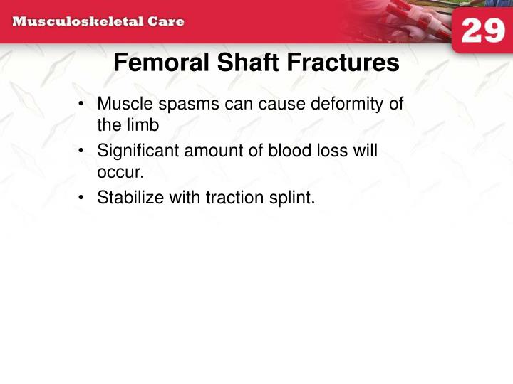femoral shaft fractures n.