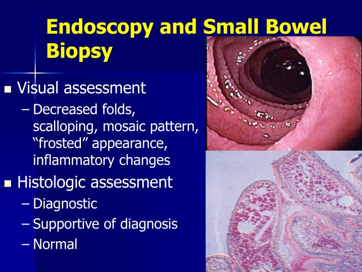 PPT Malabsorption A Clinical Approach PowerPoint Presentation ID768870