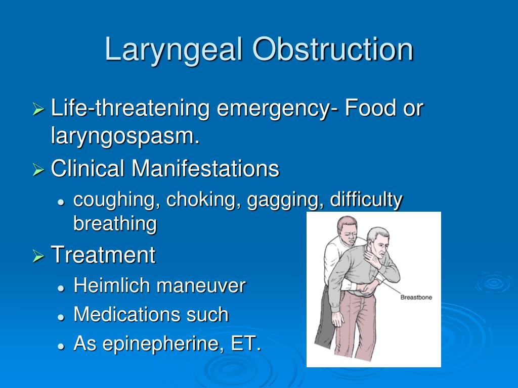 absence of laryngeal crepitus