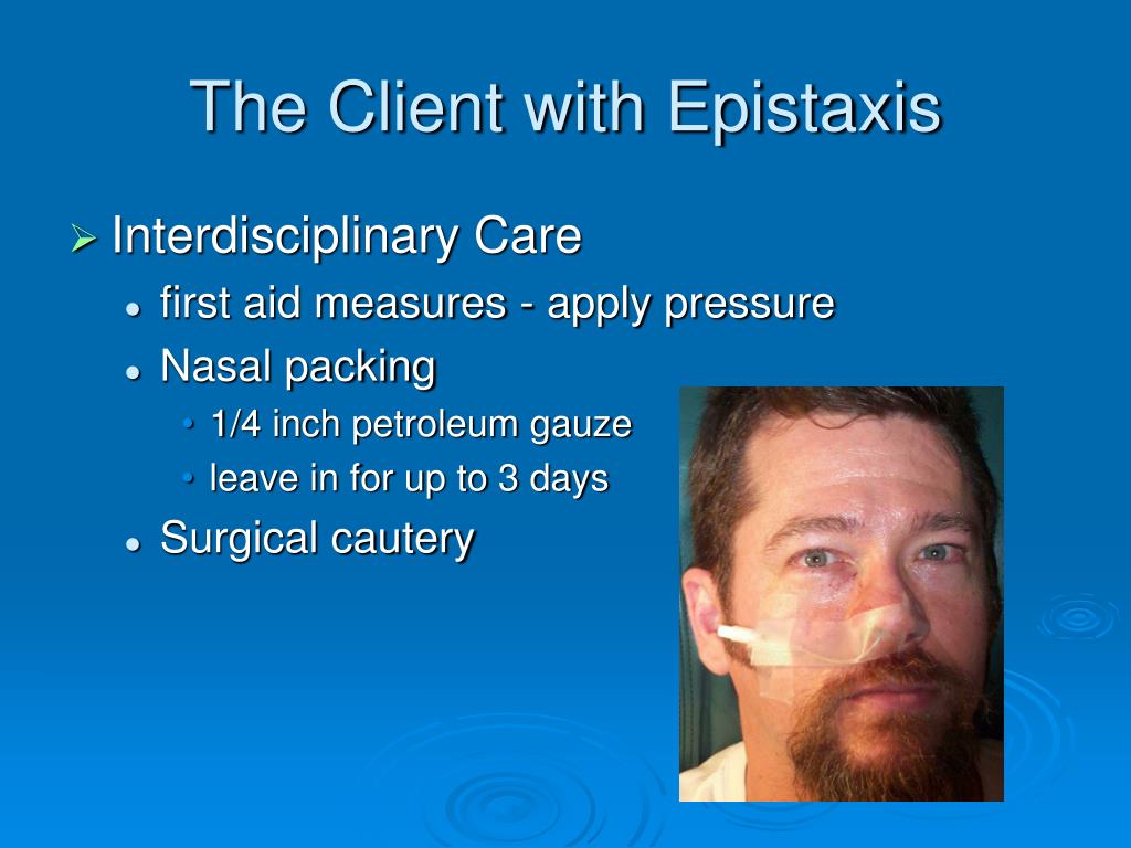 absence of laryngeal crepitus absence of laryngeal crepitus
