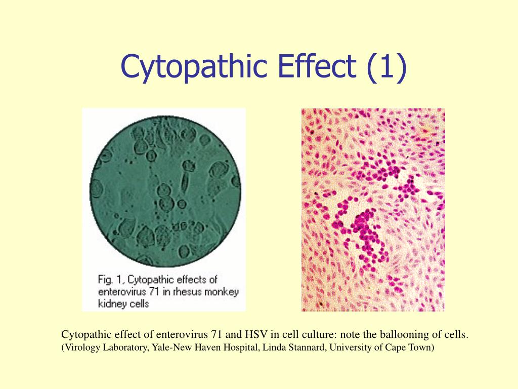 Cell effect. Viral indication and identification in Cell Culture. Cytopatic Effect.