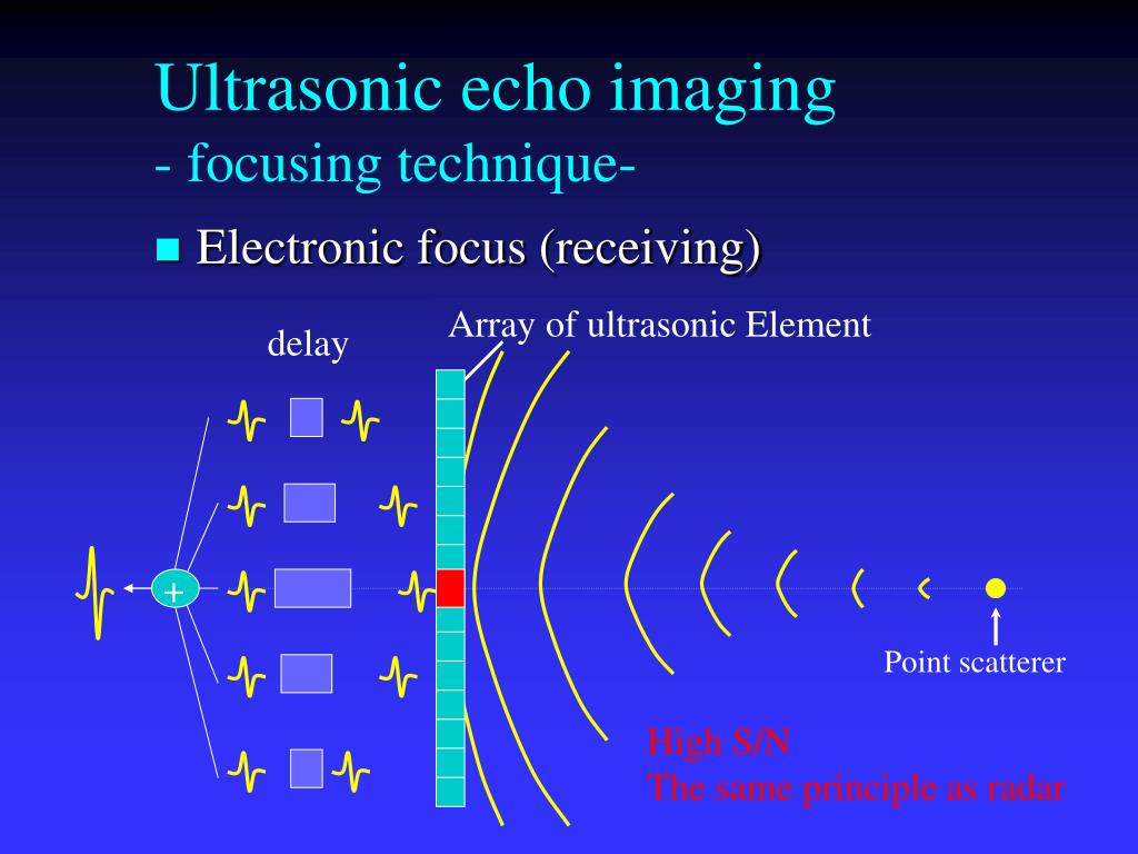 Ppt Foundations Of Medical Ultrasonic Imaging Powerpoint Presentation