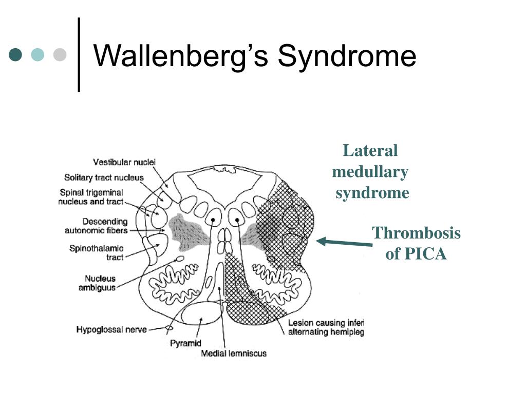 PPT Brainstem II PowerPoint Presentation Free Download ID 788109