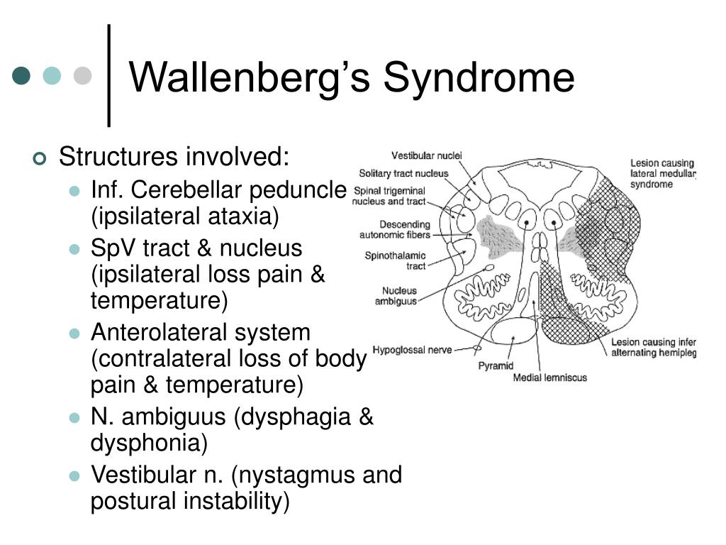 PPT Brainstem II PowerPoint Presentation Free Download ID 788109
