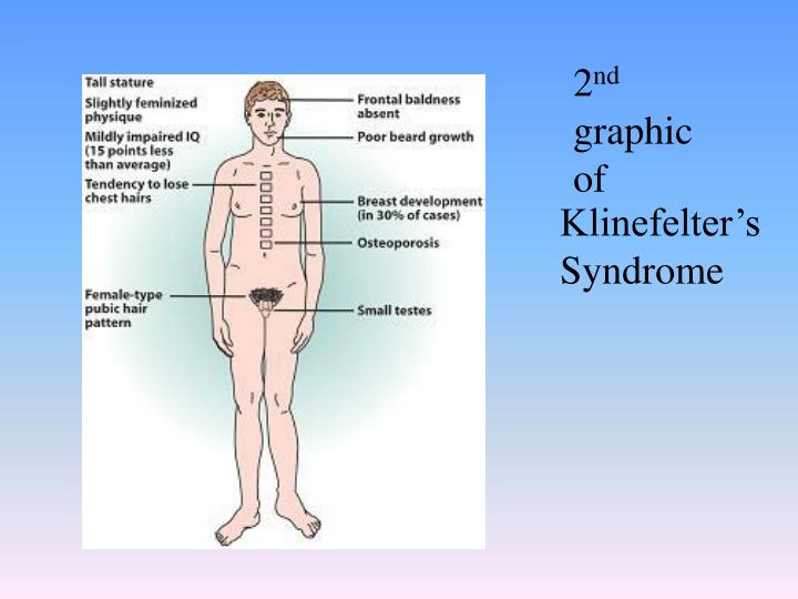 Ppt Klinefelters Syndrome Powerpoint Presentation Id 797692