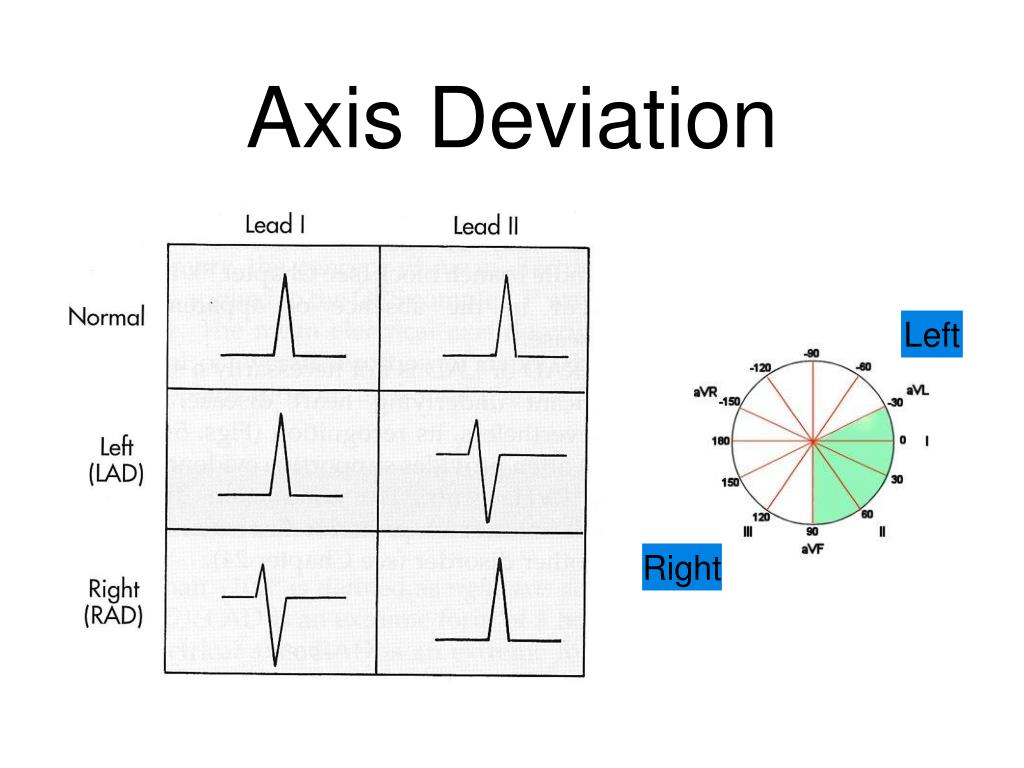 PPT Axis Deviation PowerPoint Presentation Free Download ID 799518