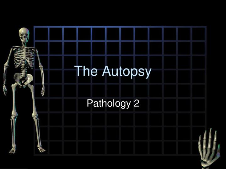 What Is Done In An Autopsy _ Autopsy: Definition, Method and Types – FWBD