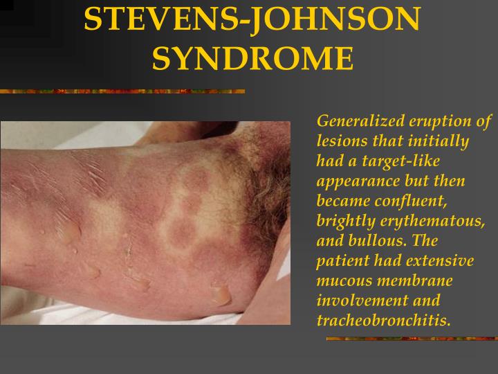 PPT DERMATOLOGY PowerPoint Presentation ID 806430