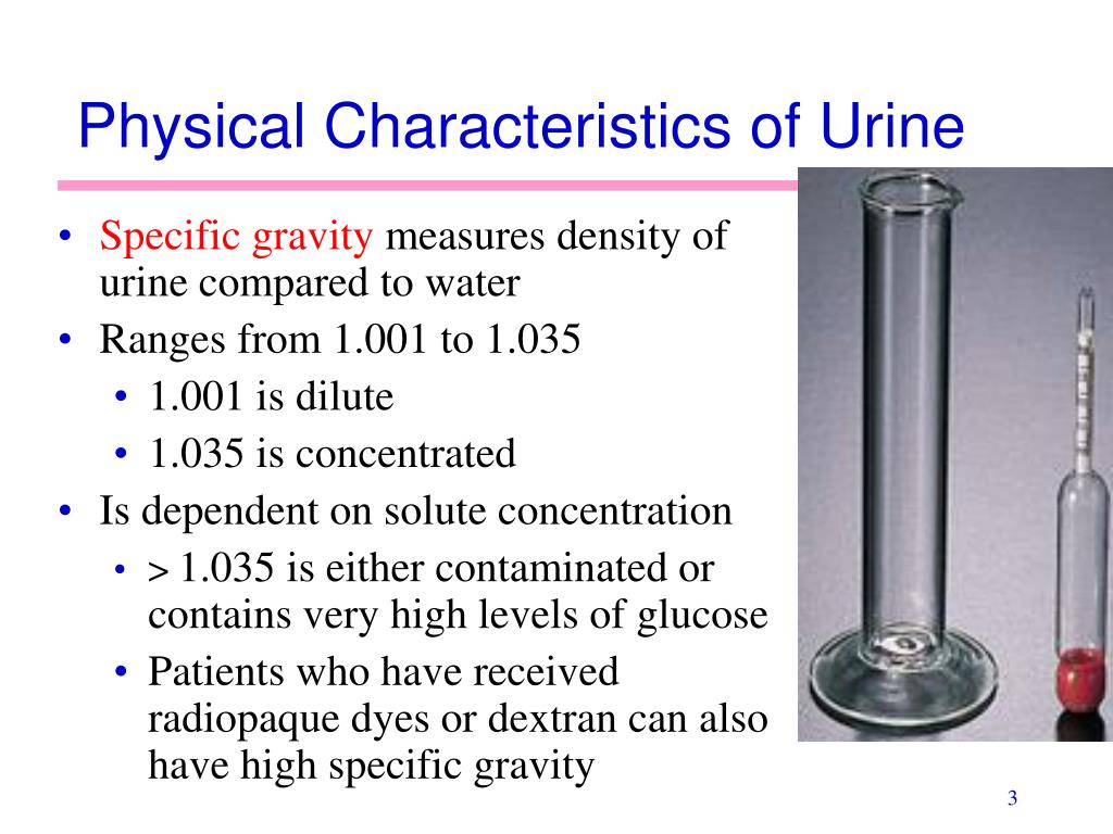 Specific activity. Specific Gravity of urine. Specific Gravity of Water. Physical characteristics. Specific Gravity in urine.