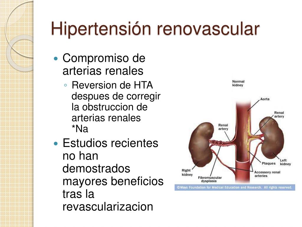 Breve guía de hipertensión intracraneana