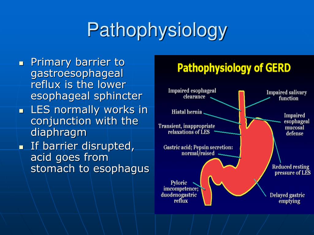 PPT - Gastroesophageal Reflux Disease PowerPoint ...