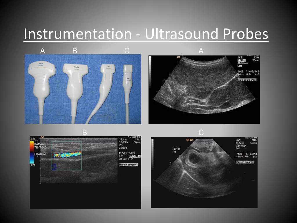 presentation ultrasound