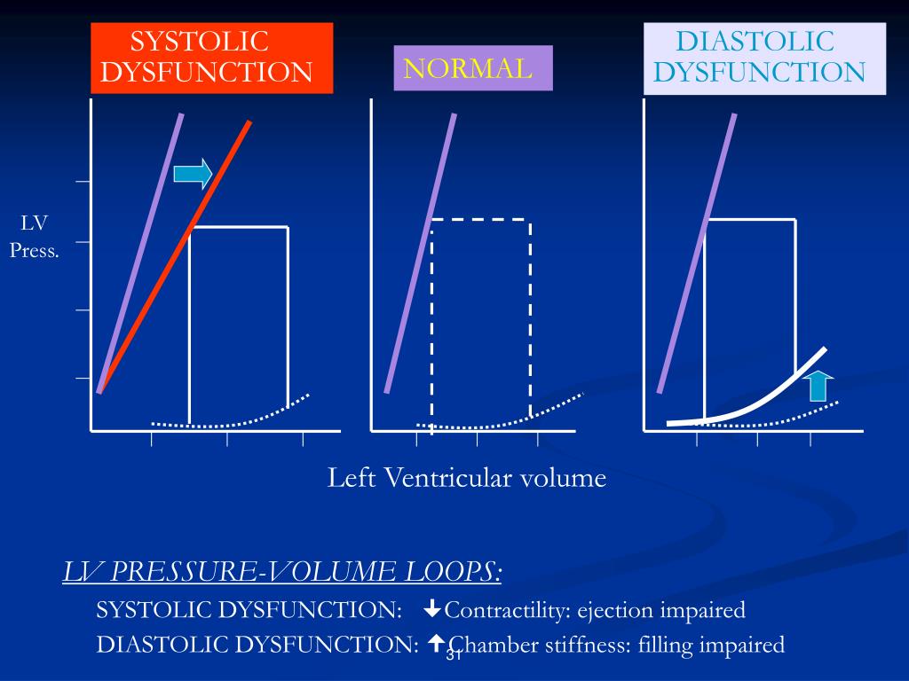 PPT - Heart Failure PowerPoint Presentation, free download - ID:824406