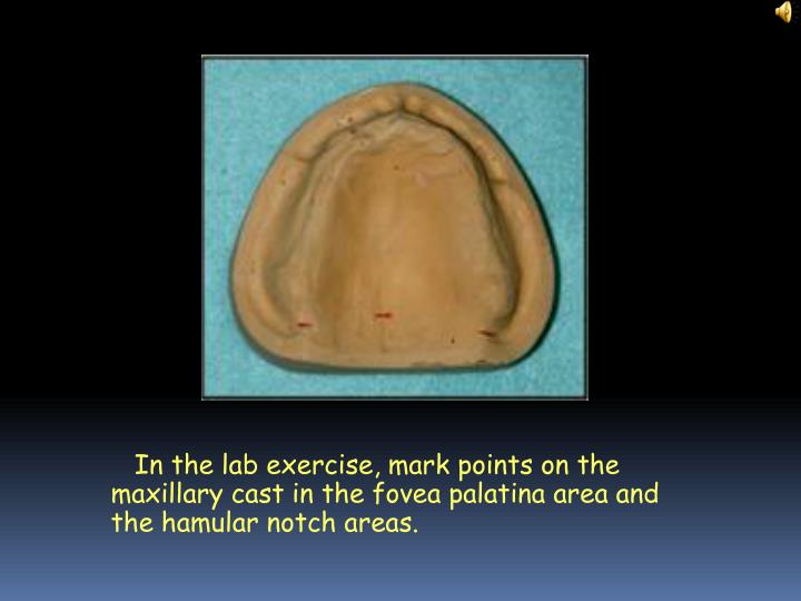 ppt posterior palatal seal powerpoint presentation id hamular notch