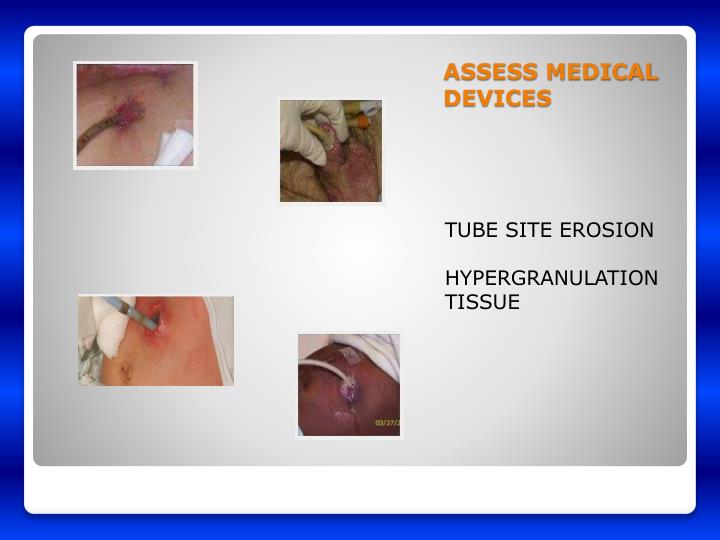 PPT - Head to Toe Skin Assessment PowerPoint Presentation ...