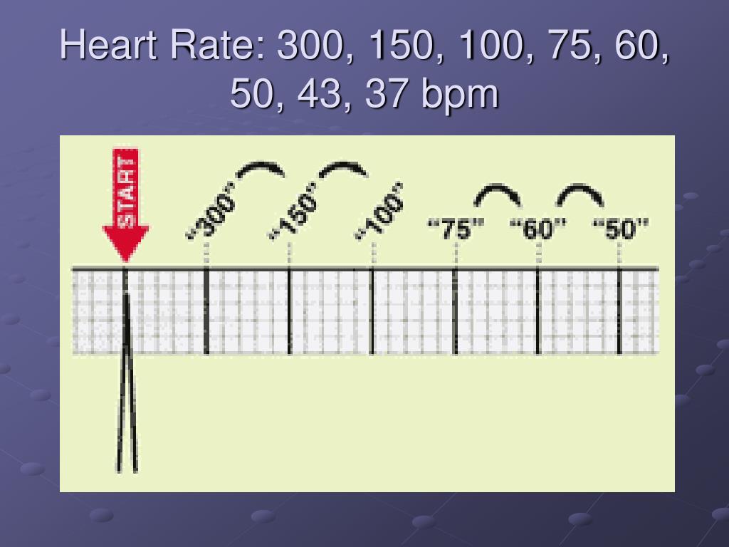 Ppt Gloucestershire Heart Failure Service Ecg Interpretation Adrian Strain Heart Failure Specialist Nurse Powerpoint Presentation Id 4598