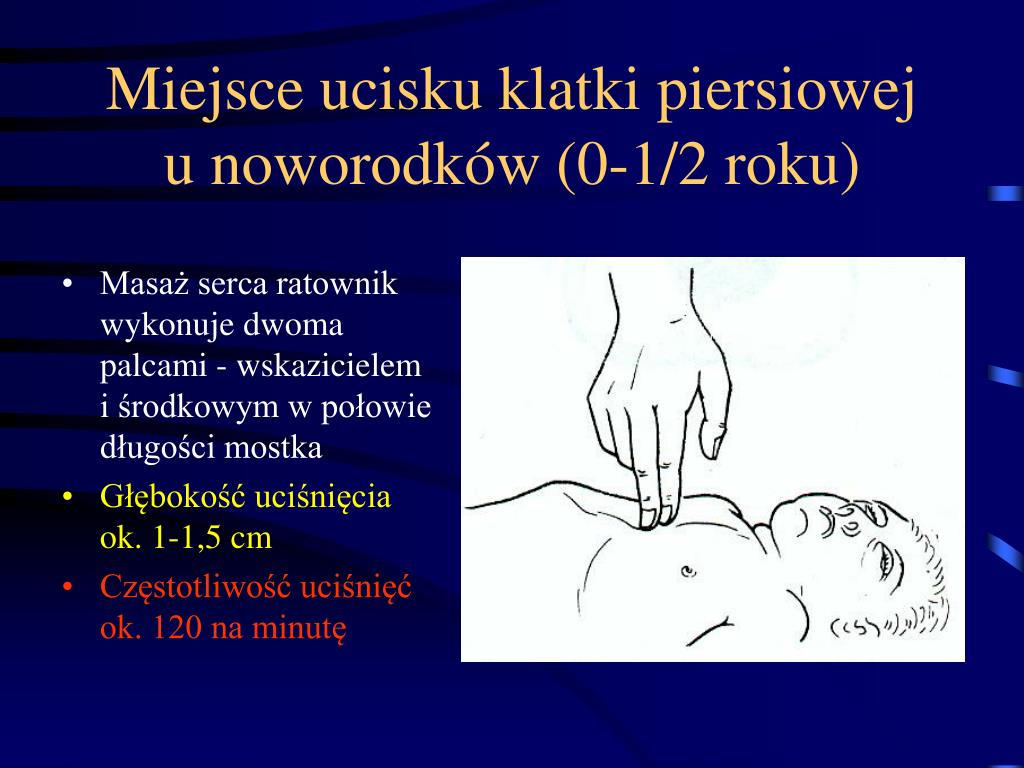 Głębokość Uciśnięć Klatki Piersiowej U Osoby Dorosłej Wynosi PPT - Reanimacja krążeniowo - oddechowa PowerPoint Presentation, free