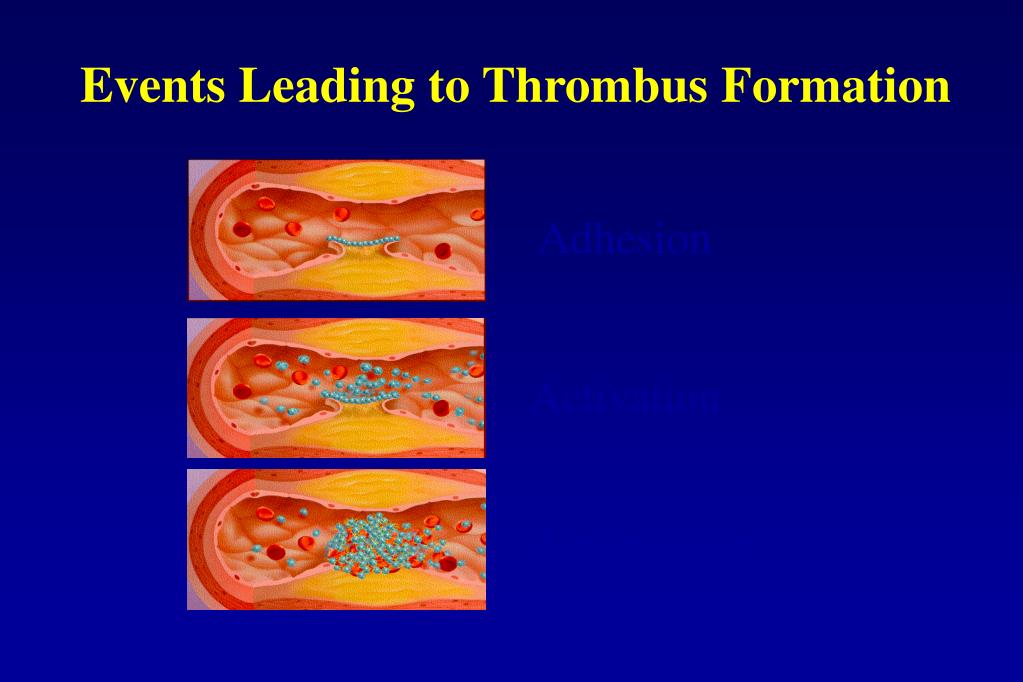 PPT - MANAGEMENT OF CARDIAC SURGICAL PATIENTS RECEIVING PLATELET ...