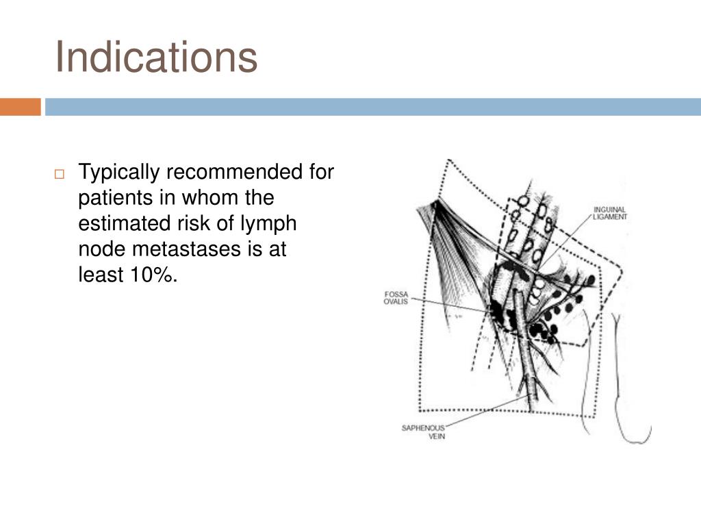 Ppt Sentinel Lymph Node Biopsy In Melanoma Powerpoint Presentation