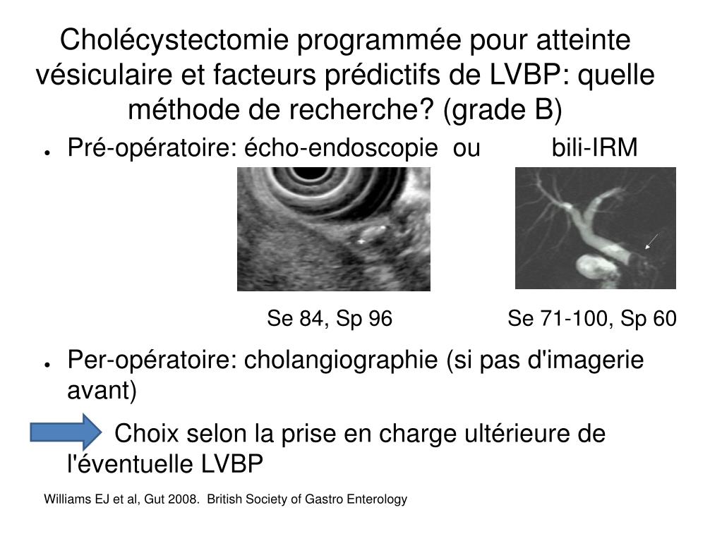 PPT Traitement De La Lithiase De La Voie Biliaire Principale Mathilde 