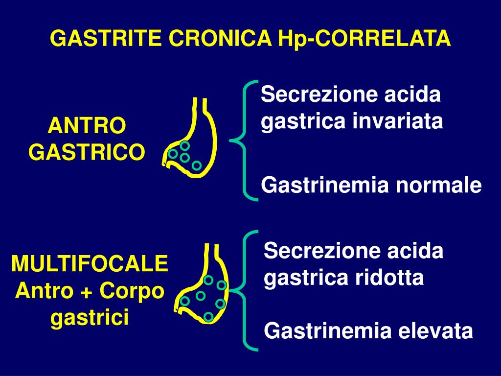 Gastrite Cronica Quiescente Non Atrofica Hp