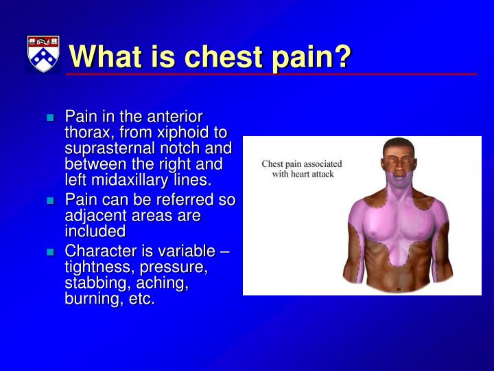 PPT - Approach to Chest Pain in the ED PowerPoint ...
