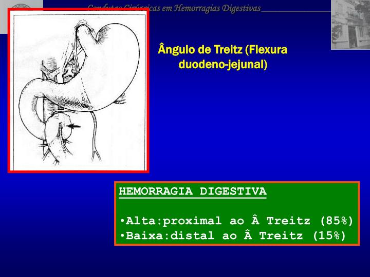 PPT - CONDUTAS CIRÚRGICAS EM HEMORRAGIAS DIGESTIVAS PowerPoint ...