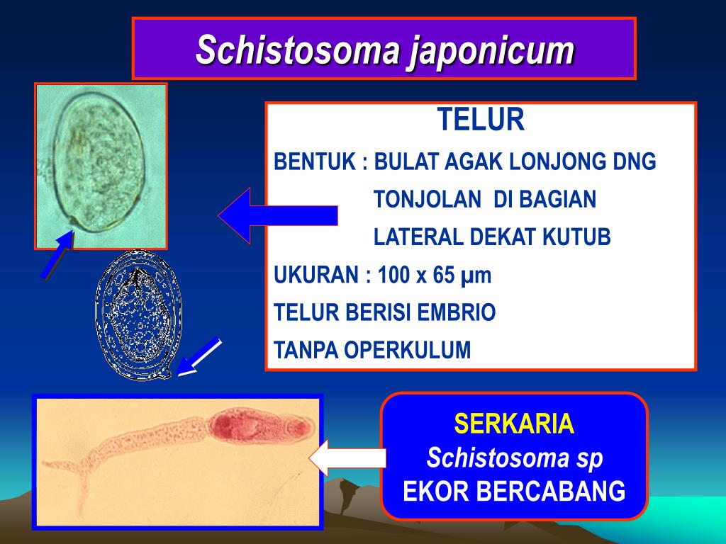 Schistosoma japonicum. Для яиц Schistosoma japonicum характерно. Schistosoma japonicum яйцо. Локализация цикле Schistosoma japonicum в организме человека -.