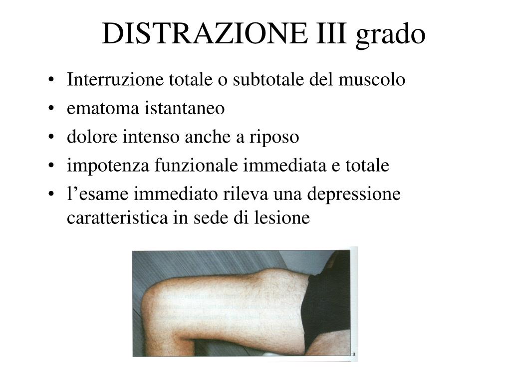 PPT Lesioni muscolari traumatiche acute PowerPoint Presentation, free