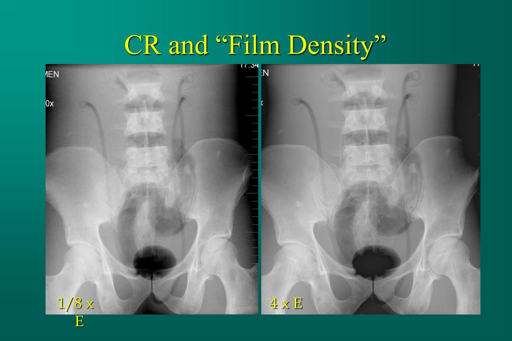 PPT Digital Radiography PowerPoint Presentation, free download ID87579