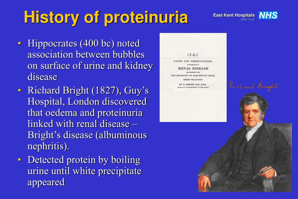 PPT - Kidney Function Testing - 2 PowerPoint Presentation, free download - ID:876933