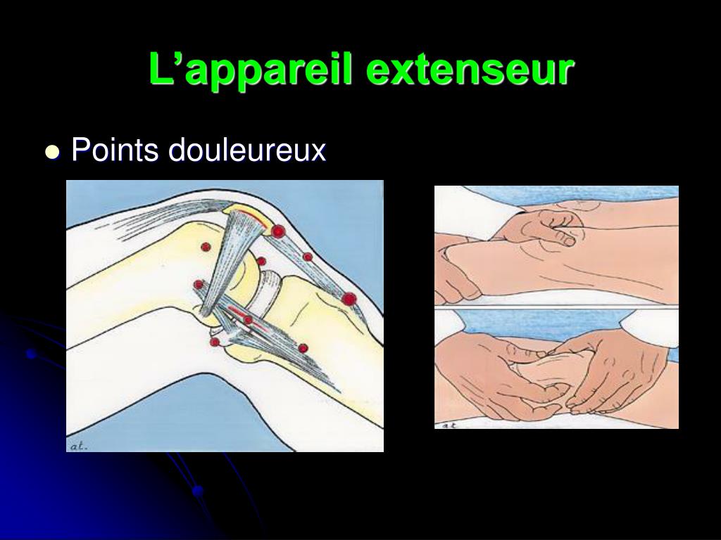 PPT - Examen du genou PowerPoint Presentation, free download - ID:878689