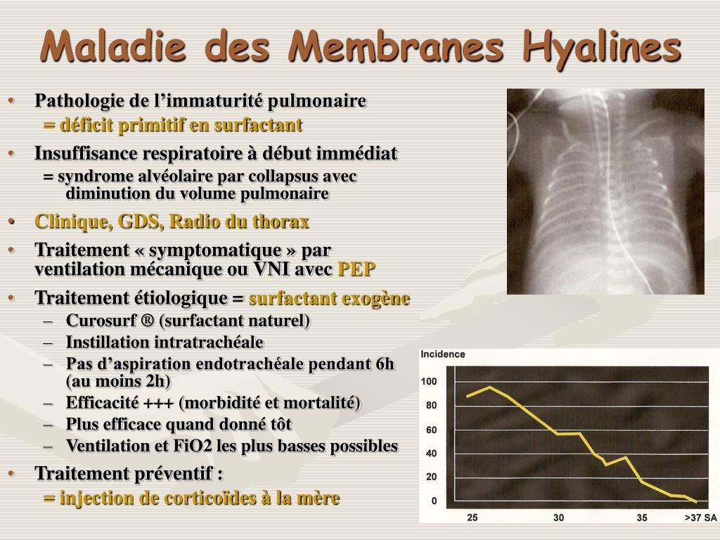 Qu'est-ce que la maladie des membranes hyalines ?