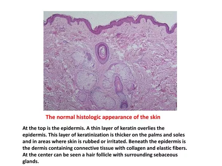 the normal histologic appearance of the skin n.